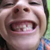los pésimos hábitos con los dientes