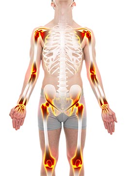 ¿Cómo se diagnostica la artritis reumatoide? - artrosis