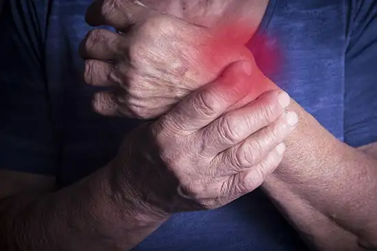 ¿Cómo se diagnostica la artritis reumatoide?