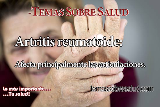 ¿Cómo se diagnostica la artritis reumatoide? - inflamación articular