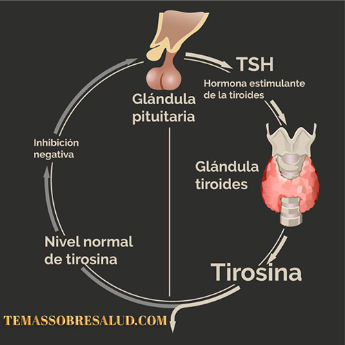 Causas que impiden diagnosticar el hipotiroidismo Hashimoto