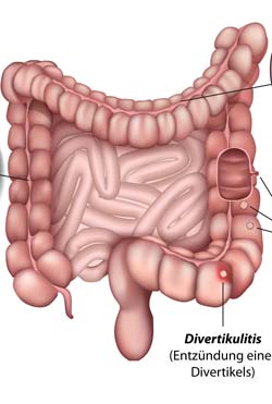 Los trastornos causados por un sistema digestivo enfermo
