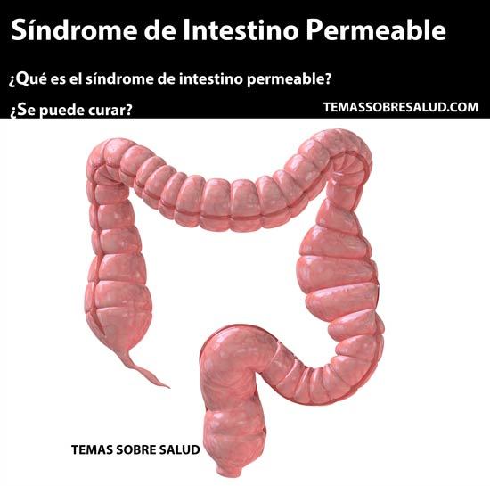 Síndrome de Intestino Irritable