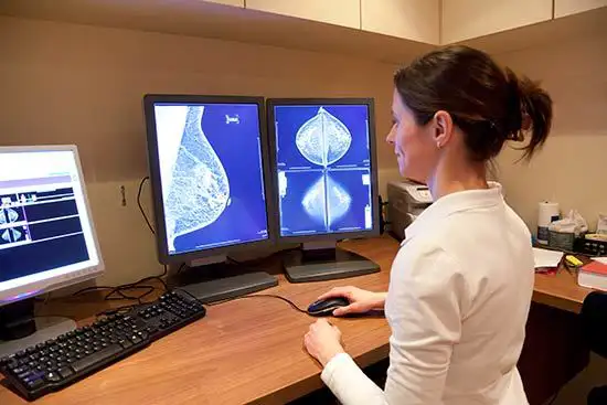 Mamografías anormales - cáncer de seno