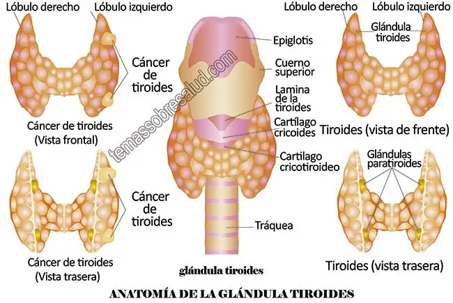 Lesiones en las glándulas paratiroides