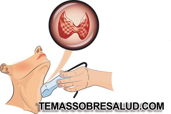 Problemas intestinales - tiroiditis de Hashimoto