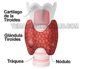 Pruebas de la glándula tiroides