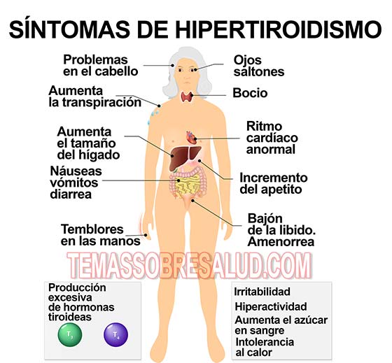 los pacientes de hipertiroidismo