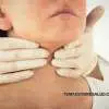 tiroiditis de Hashimoto
