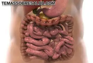 Disbiosis intestinal