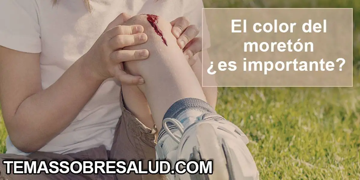 Hematomas y sangrado - ¿Qué es normal durante la niñez? Hematomas y sangrado niña con patines