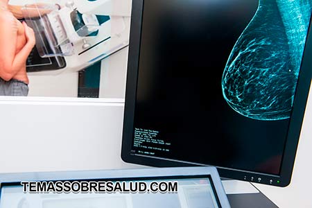 problemas en los senos - mamografías regularmente mayores dosis de radiación