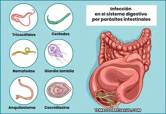 Disbiosis intestinal ¿Los parásitos pueden provocar vómitos?
