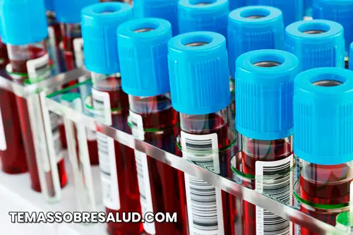 Rangos para análisis de sangre de la tiroides - Globulina fijadora de tiroxina (TBG)