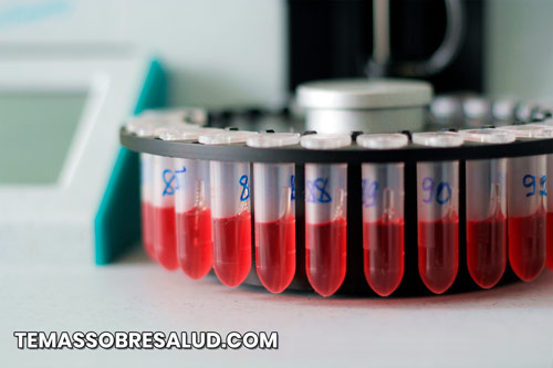 Rangos para análisis de sangre de la tiroides