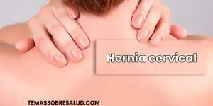 Hernia cervical dolor